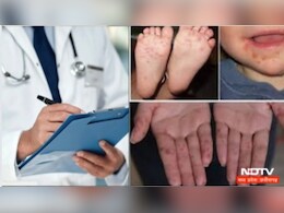 यहां छोटे बच्चों में फैल रही है ये खतरनाक बीमारी, जानें इसके लक्षण, ऐसे करें बचाव यहां छोटे बच्चों में फैल रही है ये खतरनाक बीमारी, जानें इसके लक्षण, ऐसे करें बचाव