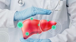 Hepatitis Deaths Could Be Prevented By Early Screenings: AIIMS Experts