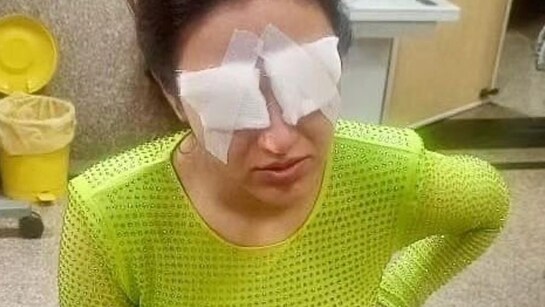 Actor Jasmine Bhasin को रैम्प वॉक करते हुए अचानक दिखना हुआ बंद, क्या है Corneal Damage, कैसे लेंस का इस्तेमाल है नुकसानदायक