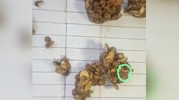 पोषण आहाराच्या नावाखाली विद्यार्थ्यांना अळ्या; मेळघाटच्या शाळेतील धक्कादायक प्रकार