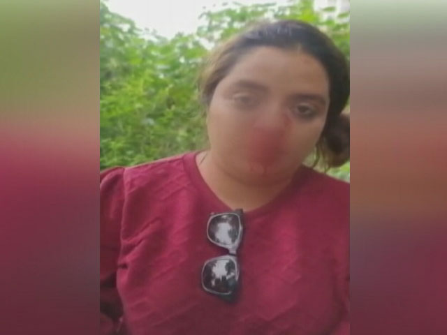 Man Who Punched Pune Woman In Road Rage Case Arrested Along With Wife
