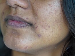 मानसून में चिपचिपी त्वचा और टैनिंग से ऐसे पाएं राहत, अपनाएं शहनाज हुसैन के बताए ये नुस्खे