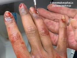 खून से लथपथ दिखे प्रियंका चोपड़ा के हाथ, सूजी हुई थीं उंगलियां, एक्ट्रेस ने तस्वीरों से उड़ाए फैन्स के होश