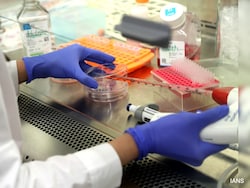 Hope For Skin Disease Patients As Scientists Grow World&#039;s 1st Human Skin In Lab