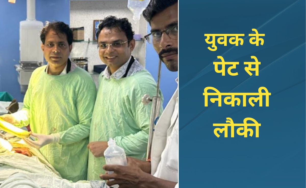 MP में युवक के पेट से निकली डेढ़ फीट की लौकी, पूरा मामला जानकर चौंक जाएंगे आप भी