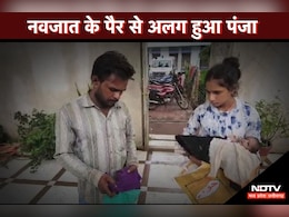 Negligence: एक माह के नवजात के पैर से अलग हुआ पंजा, मां-बाप ने लगाए जिला अस्पताल के डॉक्टरों पर आरोप