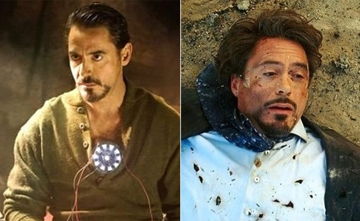 Inspired By 'Iron Man', Chinese Man Uses Magnet To Remove Metal Shards From Leg