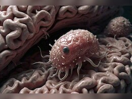 Brain Eating Amoeba: स्विमिंग करने का रखते है शौक तो हो जाएं सावधान, पानी में बैठी हो सकती है मौत! जानें कैसे