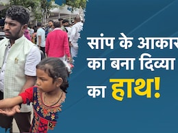 सांप के आकार का हाथ लेकर 12 साल की बच्ची ने लगाई मदद की गुहार, CM साय ने 1.5 लाख रुपये किए जारी