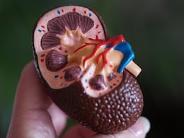 Chronic Kidney Disease Cases In Women Tripled In Last 3 Decades: Study Chronic Kidney Disease Cases In Women Tripled In Last 3 Decades: Study