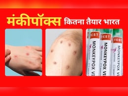 तेजी से फैल रहा मंकीपॉक्स... जानें, कैसे इस खतरनाक वायरस से निपटेगा भारत तेजी से फैल रहा मंकीपॉक्स... जानें, कैसे इस खतरनाक वायरस से निपटेगा भारत