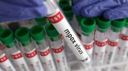 Morocco Records First Mpox Case In Marrakesh Since WHO Emergency Alert
