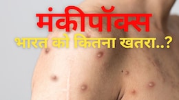 'रूप' बदलकर पाकिस्तान तक पहुंचा मंकीपॉक्स, कितना खतरनाक, जानिए हर एक बात