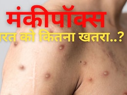 'रूप' बदलकर पाकिस्तान तक पहुंचा मंकीपॉक्स, कितना खतरनाक, जानिए हर एक बात 'रूप' बदलकर पाकिस्तान तक पहुंचा मंकीपॉक्स, कितना खतरनाक, जानिए हर एक बात