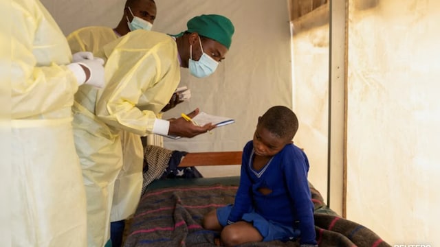 Mpox Symptoms: Understanding Mpox And Prevention Tips