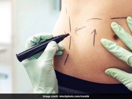 लटकते पेट को करना है अंदर, तो आज से ही खाना शुरू कर दें ये फल, कुछ ही दिनों में फैट से स्लिम नजर आने लगेंगे