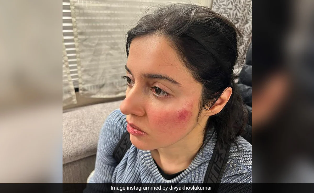 Divya Khossla Reveals She Was Badly Injured While Filming <i>Savi</i>: "Collided With An Iron Grill"