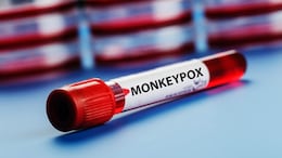 Centre Closely Monitoring Mpox Situation, No New Cases Reported In India