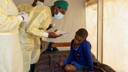 Mpox Vaccine Likely Months Away As Africa Health Body Declares Emergency