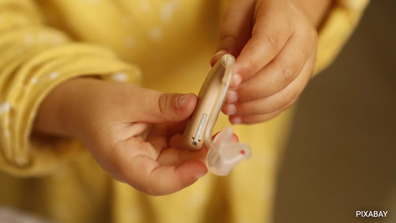 3-Year-Old Receives Rajasthan's First AI-Based Cochlear Implant At Government Hospital