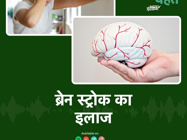 Brain Stroke Treatment: स्ट्रोक की सर्जरी कितनी सफल? डॉक्टर से जानिए episode artwork