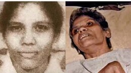 In Kolkata Horror Case, Chief Justice Cites Aruna Shanbaug. Her Chilling Story