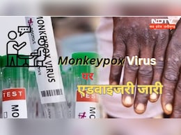 Monkeypox:  मंकी पॉक्स को लेकर छत्तीसगढ़ सरकार हुई अलर्ट, स्वास्थ्य मंत्री ने एडवाइजरी जारी कर ये कहा