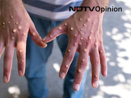 एक्सपर्ट्स ने बताया एमपॉक्स से कैसे करें खुद की सुरक्षा, जानिए किन बातों का रखना है ध्यान एक्सपर्ट्स ने बताया एमपॉक्स से कैसे करें खुद की सुरक्षा, जानिए किन बातों का रखना है ध्यान