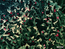 वायरल गैस्ट्रोएंटेराइटिस या पेट का फ्लू क्यों होता है? एक्सपर्ट से जानिए कारण, जटिलताएं, लक्षण, इलाज और रोकथाम के उपाय वायरल गैस्ट्रोएंटेराइटिस या पेट का फ्लू क्यों होता है? एक्सपर्ट से जानिए कारण, जटिलताएं, लक्षण, इलाज और रोकथाम के उपाय