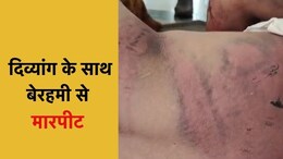 गुना रेलवे स्टेशन पर दिव्यांग के साथ बेरहमी से मारपीट, GRP के जवानों पर पिटाई करने का आरोप, SP से की शिकायत