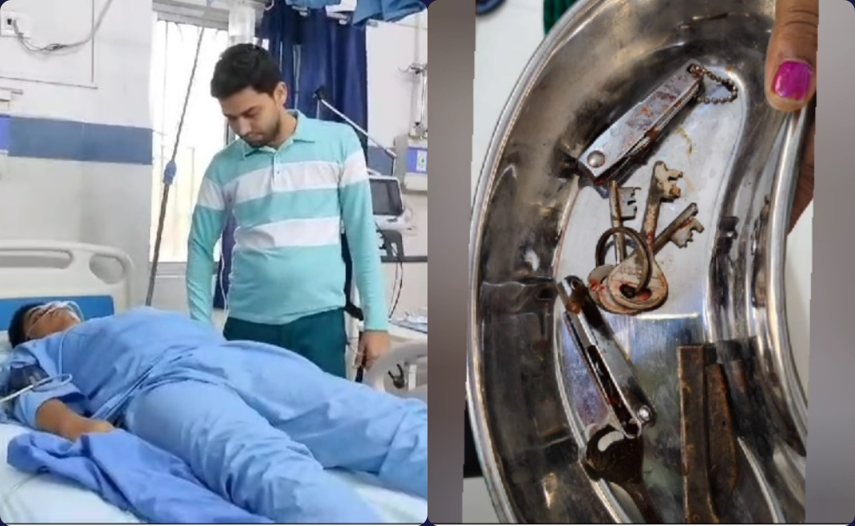 चाकू, नेल कटर, चाबी का छल्ला....एक-एक कर युवक निगल गया सब... जानें पर क्या हुआ