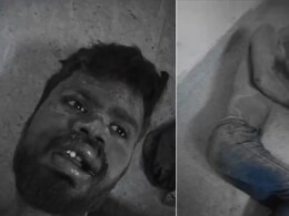 Agra Man Claims Buried Alive By 4 Men, Saved By Stray Dogs Who Dug Him Up