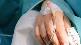 UK Student, 20, "Died For 25 Minutes" During Surgery After Extreme Sunburn