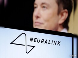 Neuralink Successfully Implanted In 2nd Patient, Working Well: Elon Musk Neuralink Successfully Implanted In 2nd Patient, Working Well: Elon Musk