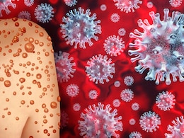 Mpox Virus: कोविड की तरह लॉकडाउन करवा सकता है मंकीपॉक्स वायरस? क्या कहते हैं एक्सपर्ट Mpox Virus: कोविड की तरह लॉकडाउन करवा सकता है मंकीपॉक्स वायरस? क्या कहते हैं एक्सपर्ट