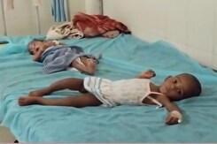 Nearly 200 Children Malnourished Among Sahariya Tribals In Rajasthan Nearly 200 Children Malnourished Among Sahariya Tribals In Rajasthan