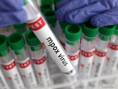 Mpox: Recent Cases, Signs & What To Do If Youre At Risk