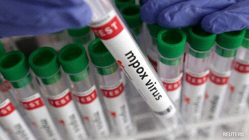 Bengaluru Reports 1st Mpox Case Of 2025 In 40-Year-Old Man With Travel History
