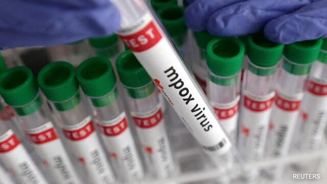 If you suspect you have Mpox or are experiencing symptoms, seek medical advice promptly