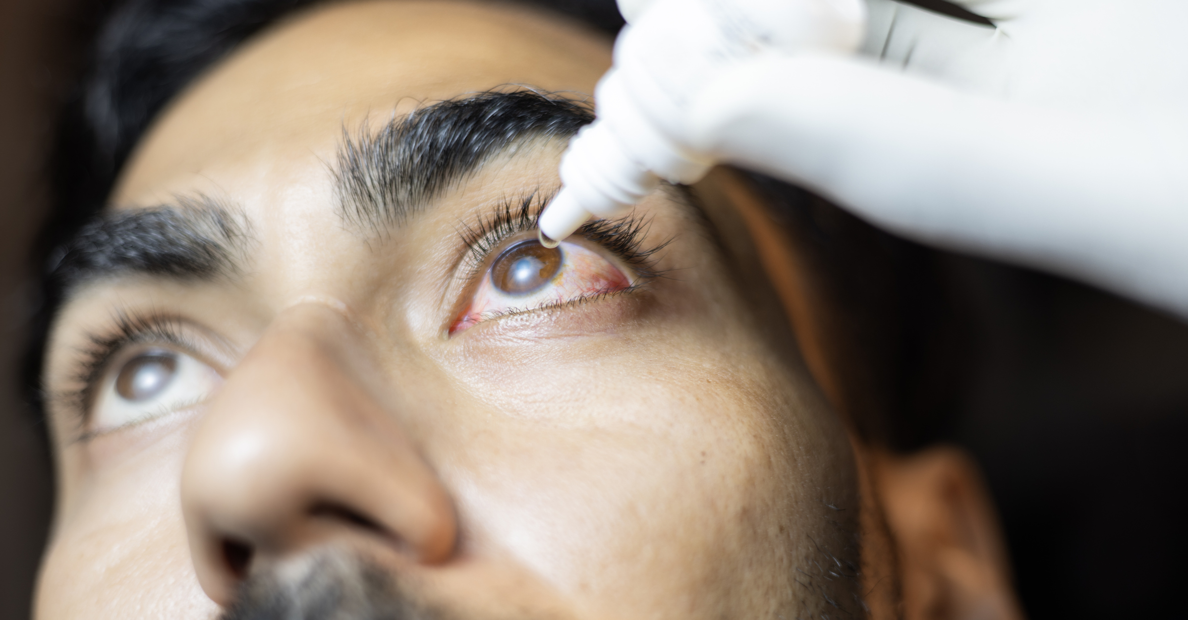 World Sight Day 2024: How To Prevent Serious Eye Conditions