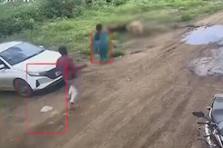 5-Year-Old Attacked, Injured By Pack Of Stray Dogs In Pune 5-Year-Old Attacked, Injured By Pack Of Stray Dogs In Pune