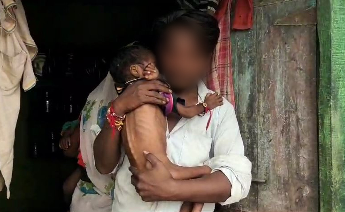 Nearly 200 Children Malnourished Among Sahariya Tribals In Rajasthan
