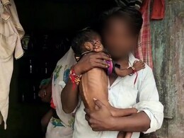 Malnourished Children: मुंबई उपनगरात सर्वाधिक कुपोषित बालके, राज्यातील चिंताजनक आकडेवारी समोर