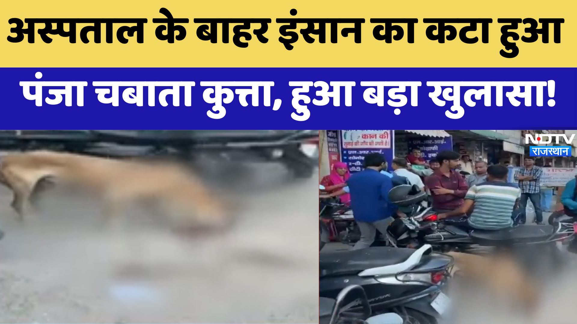 Rajasthan News: SMS Hospital के बाहर इंसान का कटा हुआ पंजा चबाते कुत्ते का Video Viral । Breaking