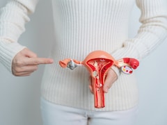 Expert Debunks Common PCOS Myths, Says It Isn't The Same For Everyone