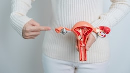 PCOS Name Changed To PMOS: How This Impacts Women Globally And In India