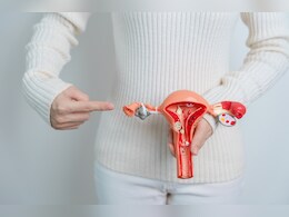 PCOS का नाम बदलकर PMOS क्यों किया गया? जानिए क्या बदलेगा महिलाओं के लिए