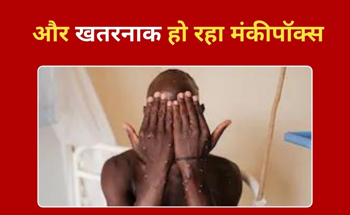 यूरोप और एशिया के बाद अब अमेरिका पहुंचा मंकीपॉक्स, जेल में कई कैदी हुए संक्रमित