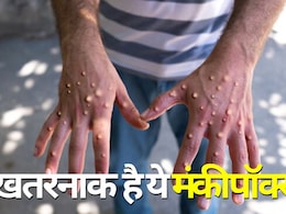 क्या भारत में पैर पसार रहा है मंकीपॉक्स ? क्यों है ये इतना खतरनाक, यहां समझिए  क्या भारत में पैर पसार रहा है मंकीपॉक्स ? क्यों है ये इतना खतरनाक, यहां समझिए