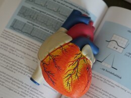 Millions At Risk Of 'Silent Killer', A Condition That Can Cause Stroke Or Sudden Death Millions At Risk Of 'Silent Killer', A Condition That Can Cause Stroke Or Sudden Death